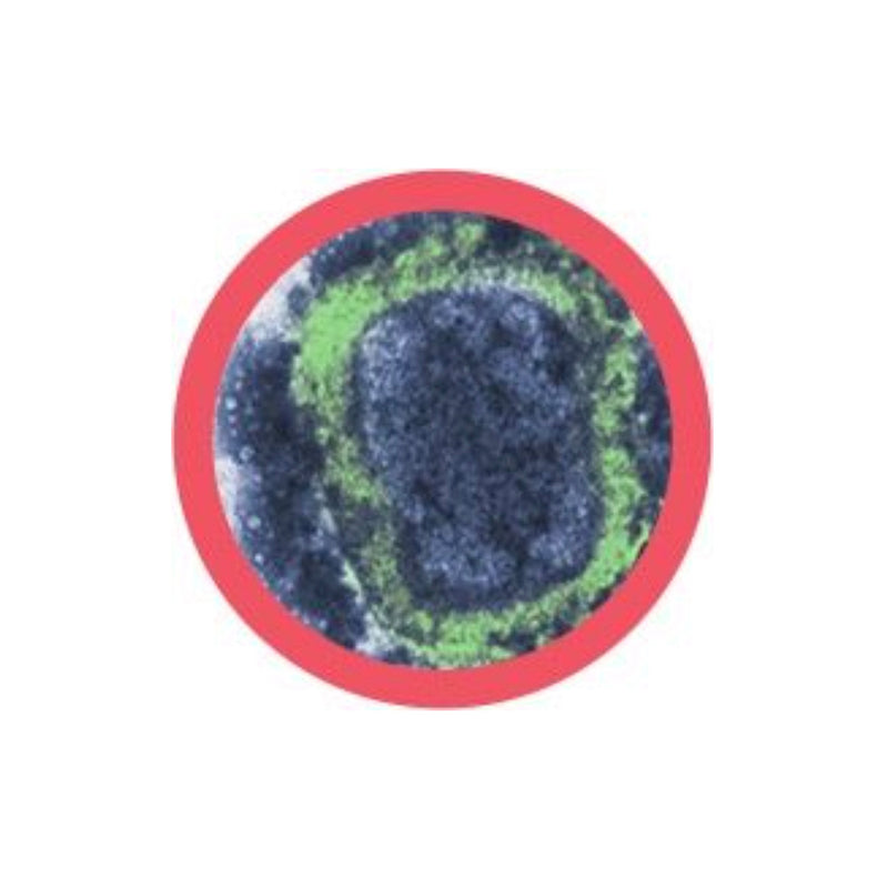 Mini-giantmicrobes box - Historical pests-zoom-