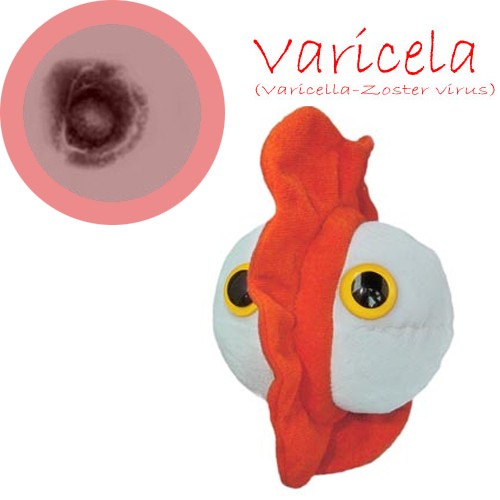 GiantMicrobes (peluche) - Zoster Virus (Varicela)-zoom-